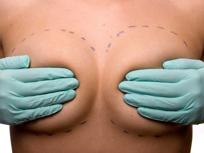 Göğüs Büyütme Operasyonu Hakkında Bilmeniz Gerekenler